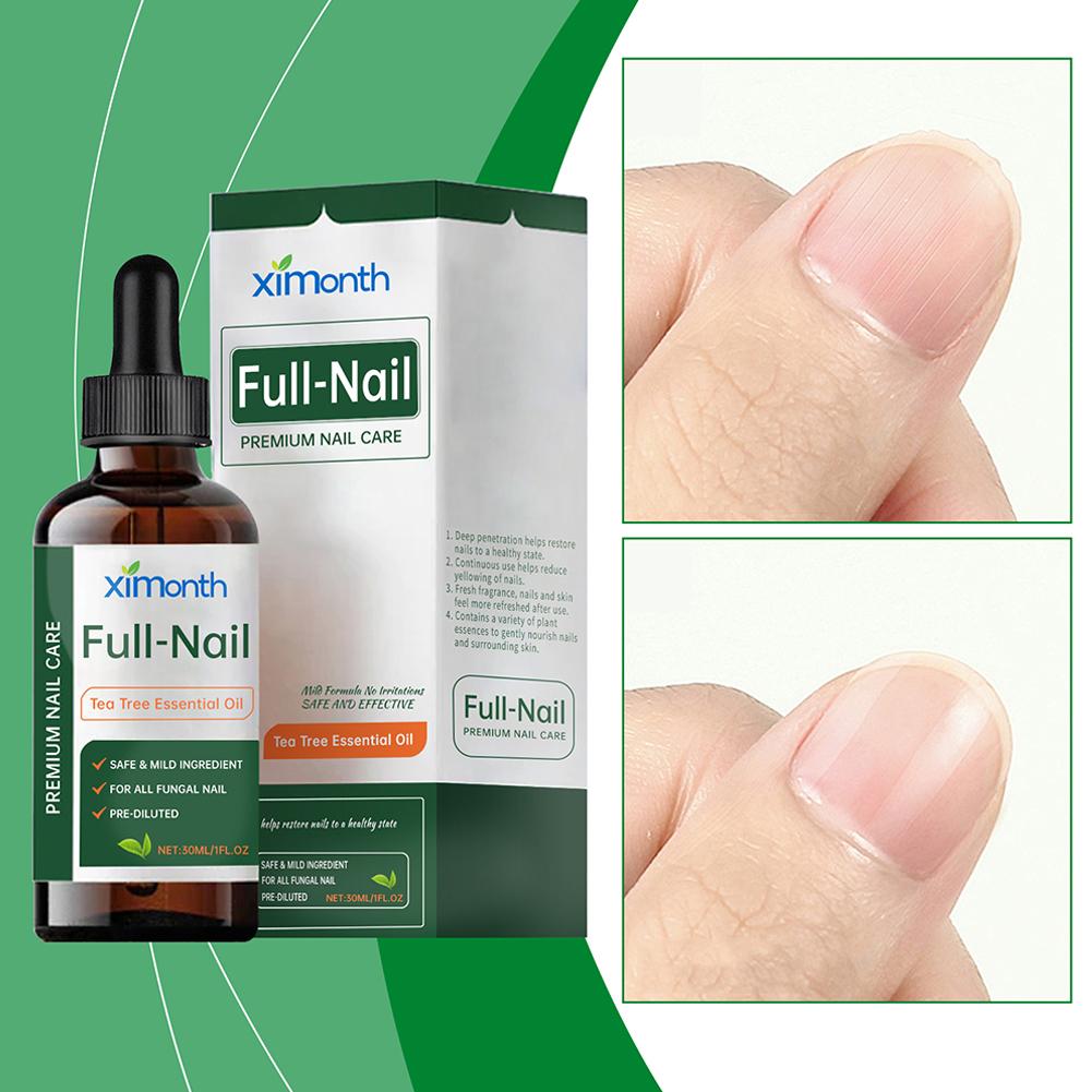 30ml Nail Fungus Tea Tree Esse - Herbal Wellness Tea review and price