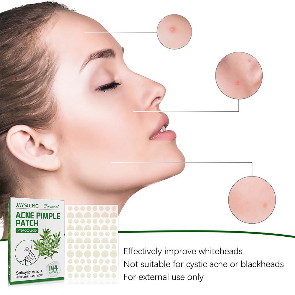 144pcs Acne Pimple Patches Tra - Herbal Wellness Tea review and price