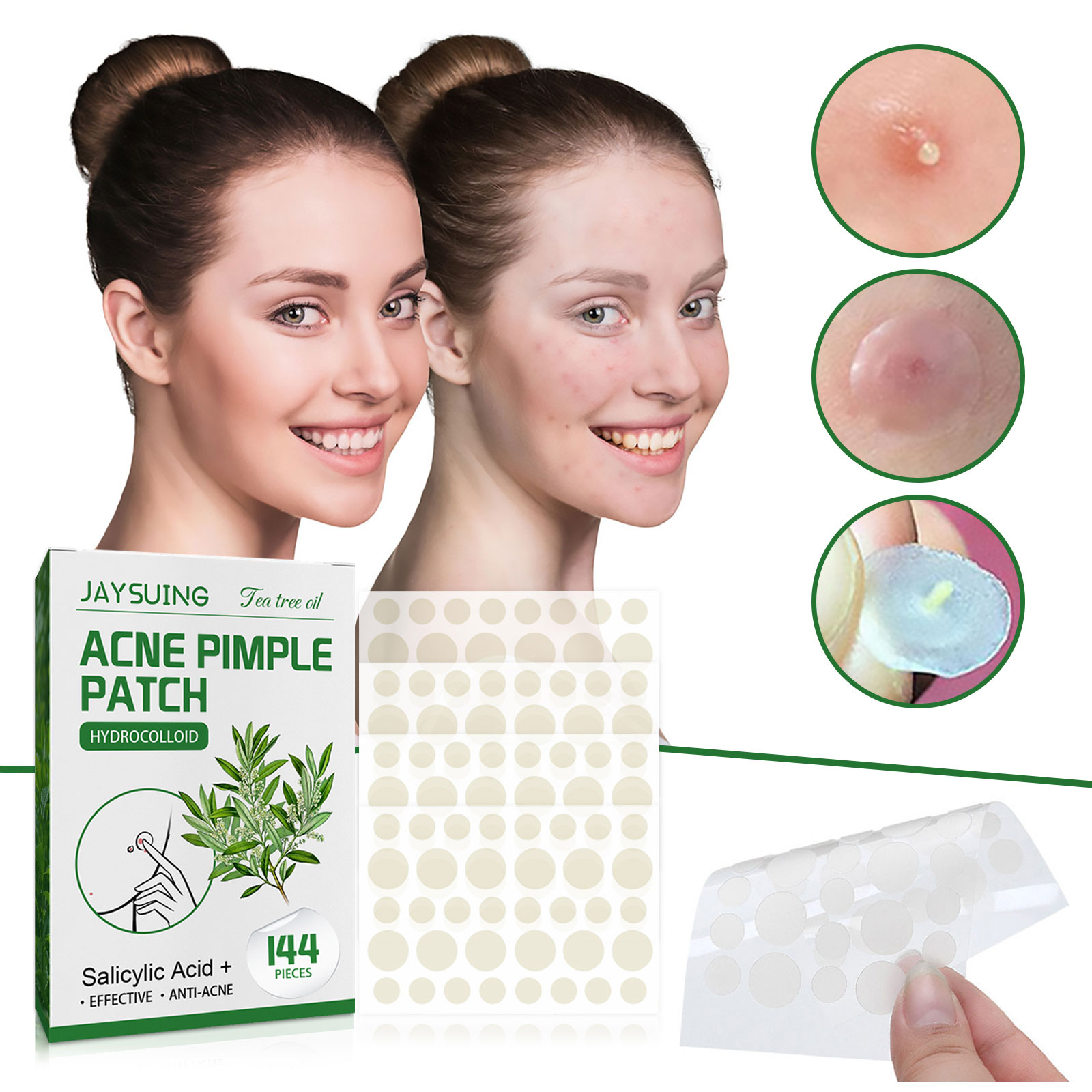 Acne Pimple Patches Translucen - Herbal Wellness Tea review and price